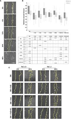 Different Functions of Recombinantly Expressed Domains of Tenascin-C in Glial Scar Formation